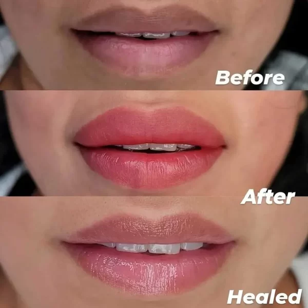 healed-dark-lip-pmu-600x600 Evenflo Neutralizer Set
