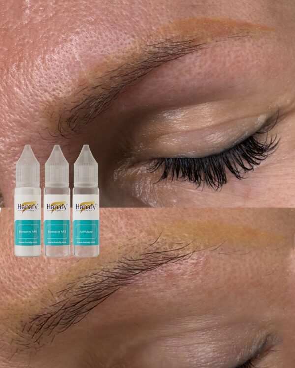 Hanafy Removal Activator