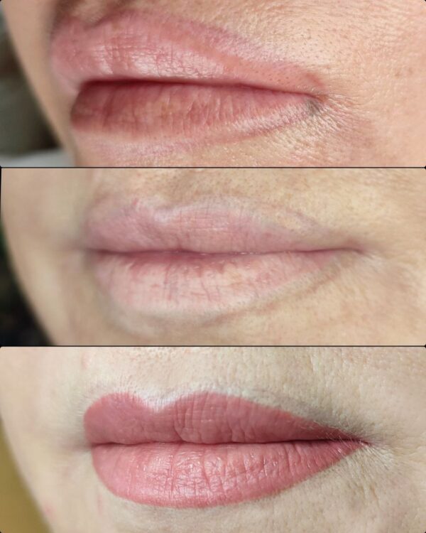Hanafy Acid REMOVER Nº2