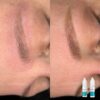 Hanafy Acid REMOVER Nº2