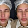Hanafy Acid REMOVER Nº2