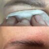 Hanafy Acid REMOVER Nº2