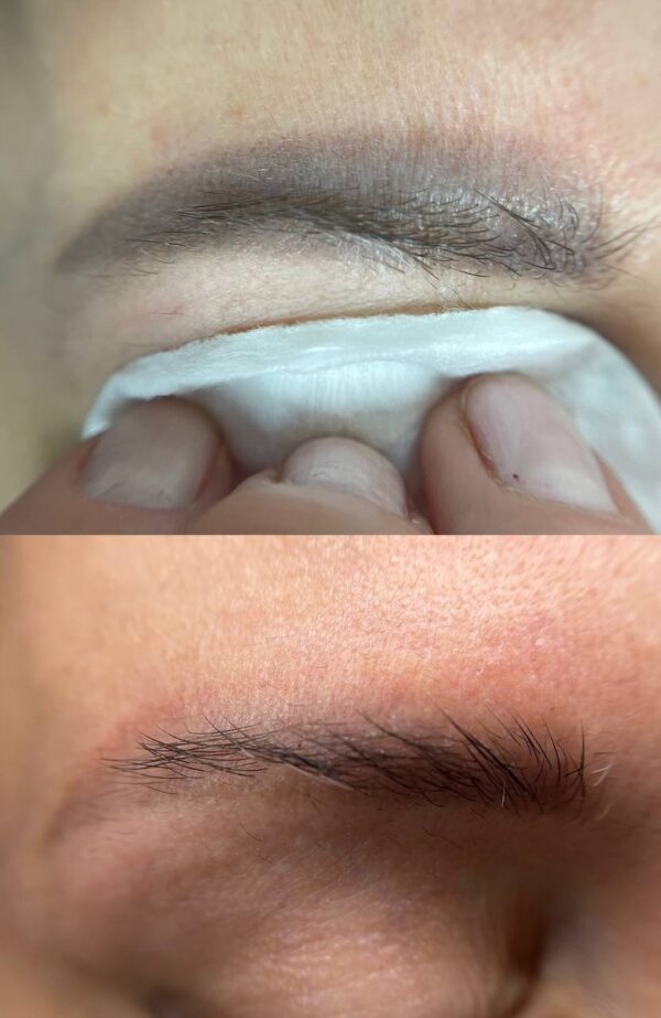 Hanafy Acid REMOVER Nº2