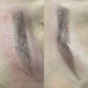 Hanafy Acid REMOVER Nº2