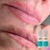 Hanafy Acid REMOVER Nº2